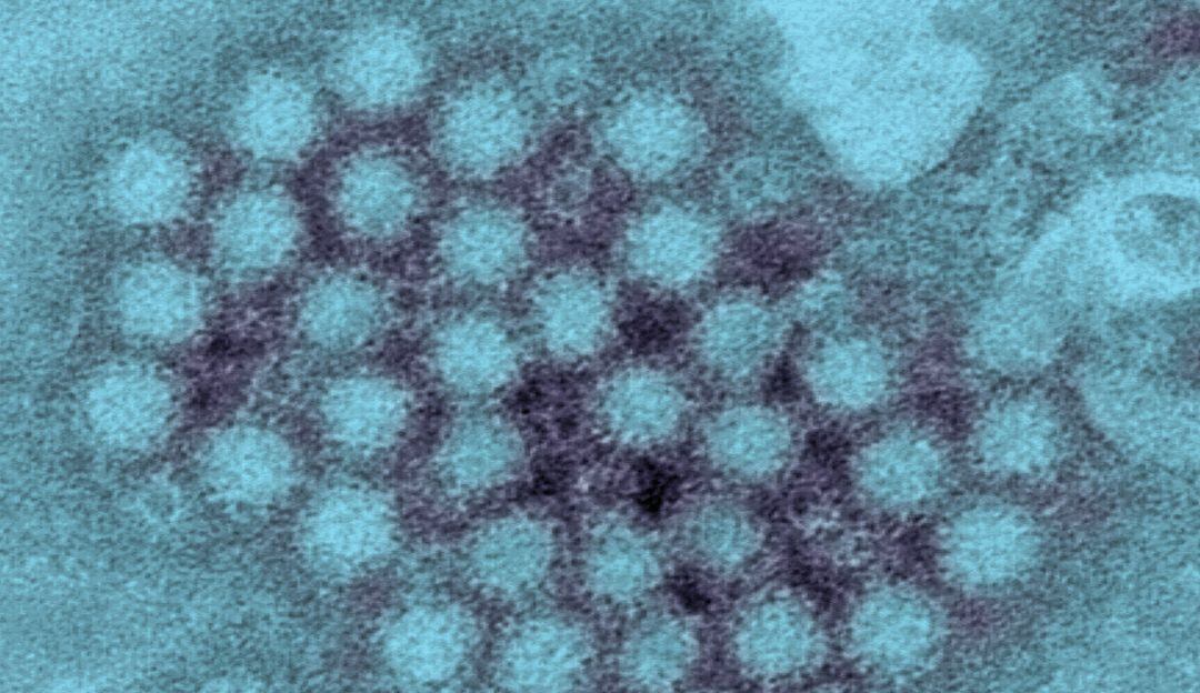 Norovirus 