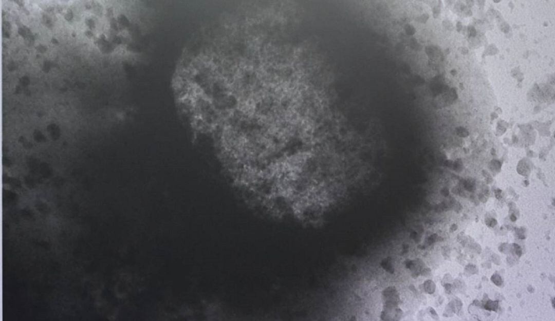 La autoridad de salud conminó a las IPS a notificar de manera inmediata los casos que detecten, como antecedente, viaje o nexo epidemiológico