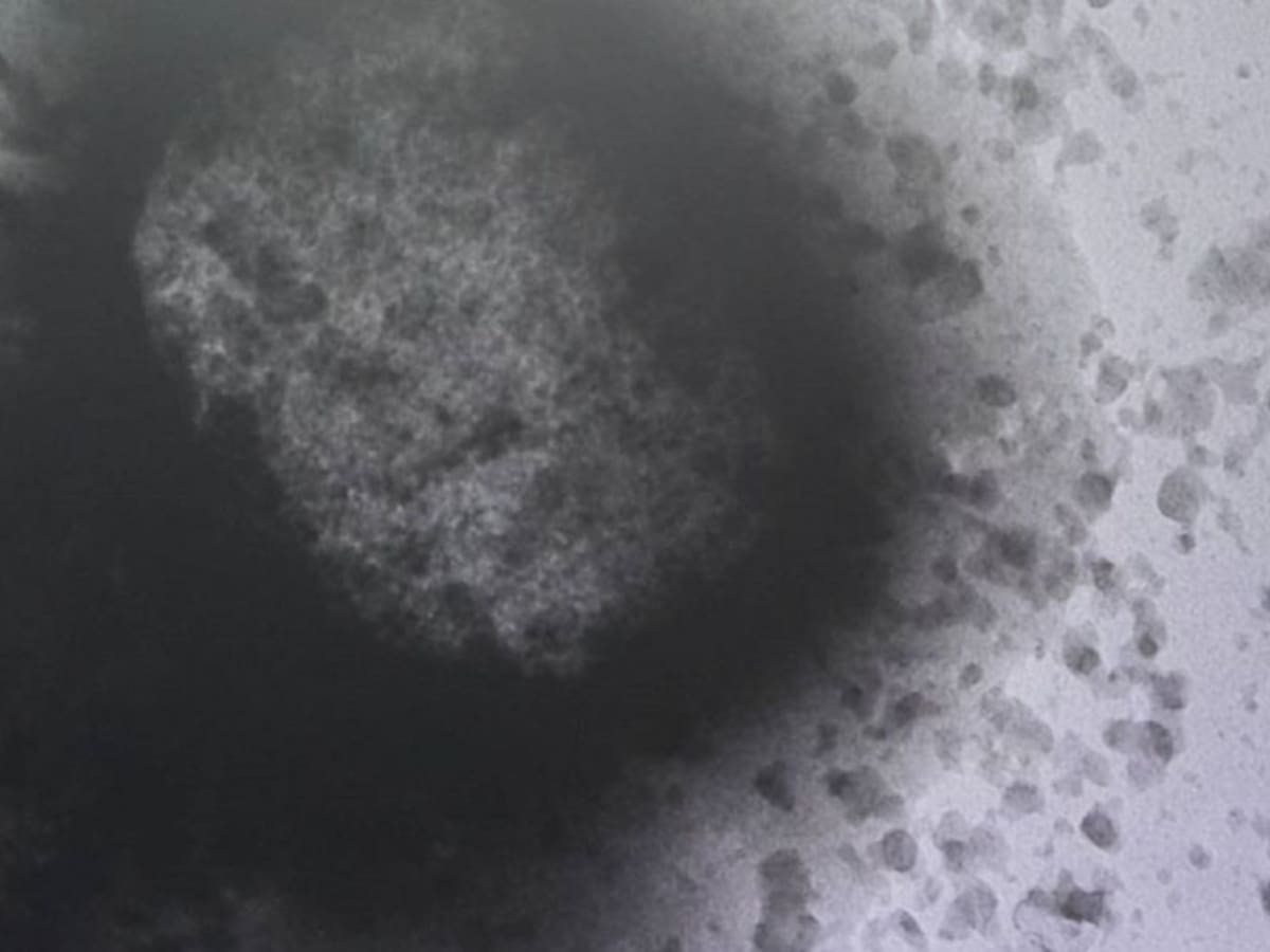 DADIS alertó a IPS probable introducción de casos de viruela símica