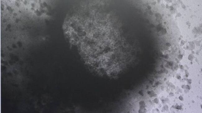 La autoridad de salud conminó a las IPS a notificar de manera inmediata los casos que detecten, como antecedente, viaje o nexo epidemiológico