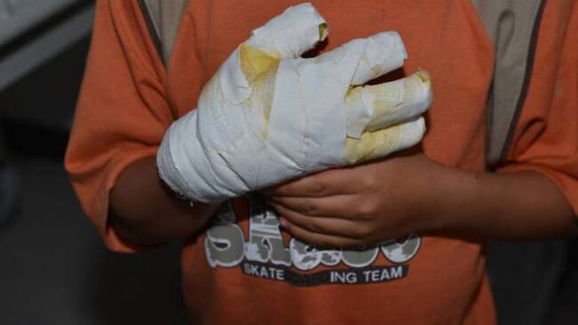 Aunque ninguno de los heridos con pólvora revistió gravedad, autoridades expresaron preocupación.