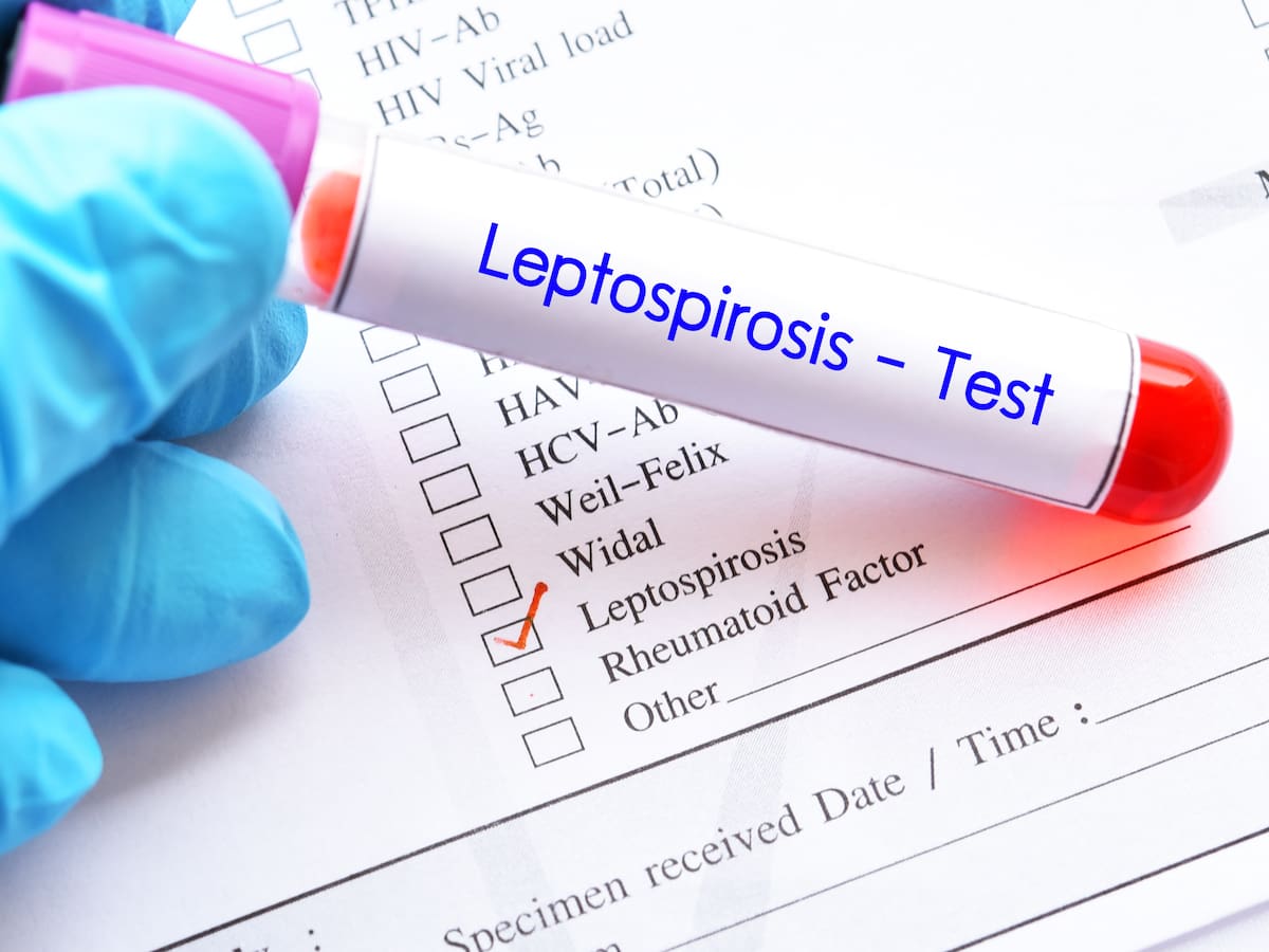 La Secretaría de Salud de Antioquia afirma que NO hay una epidemia de Leptospirosis