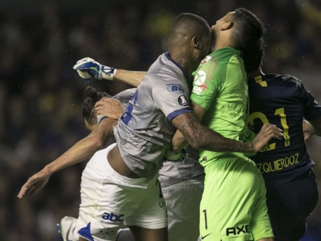 El portero de Boca Juniors sufrió una fractura de maxilar