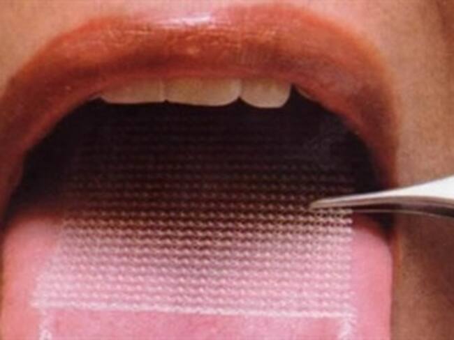 Secretaría de Salud alertó sobre la utilización de “malla adelgazante”