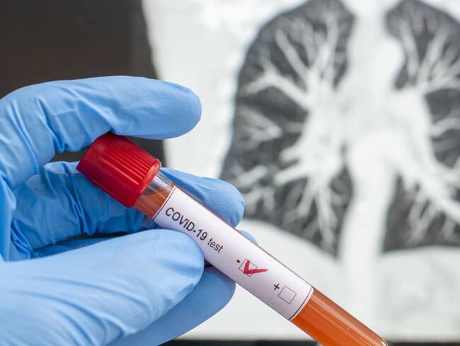 Ocho docentes han muerto por sospecha de COVID-19: Adea