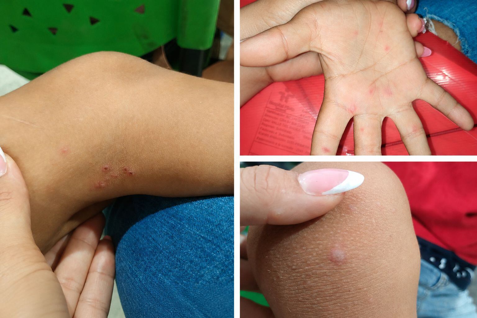Foto: Cortesía para caracol radio