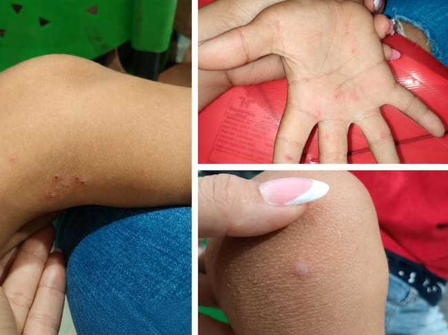 Foto: Cortesía para caracol radio
