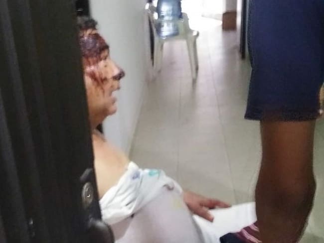 En Santa Marta, asaltantes golpean a sacerdote para robar en su casa