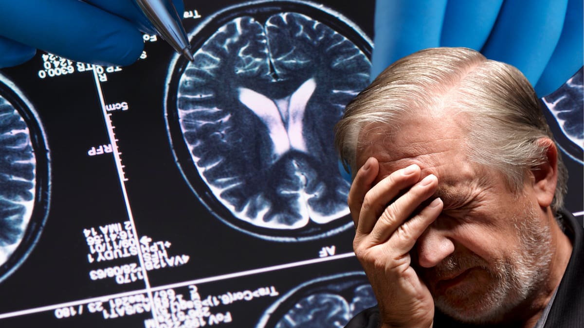 ¿Cuándo olvidarse de cosas se convierte en una alerta? Síntomas y claves para prevenir el Alzheimer