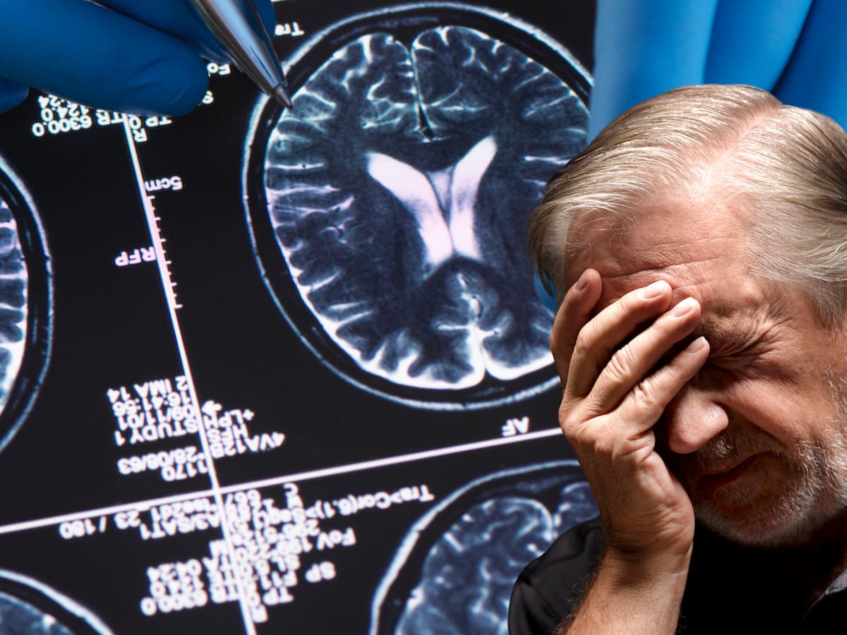 ¿Cuándo olvidarse de cosas se convierte en una alerta? Síntomas y claves para prevenir el Alzheimer
