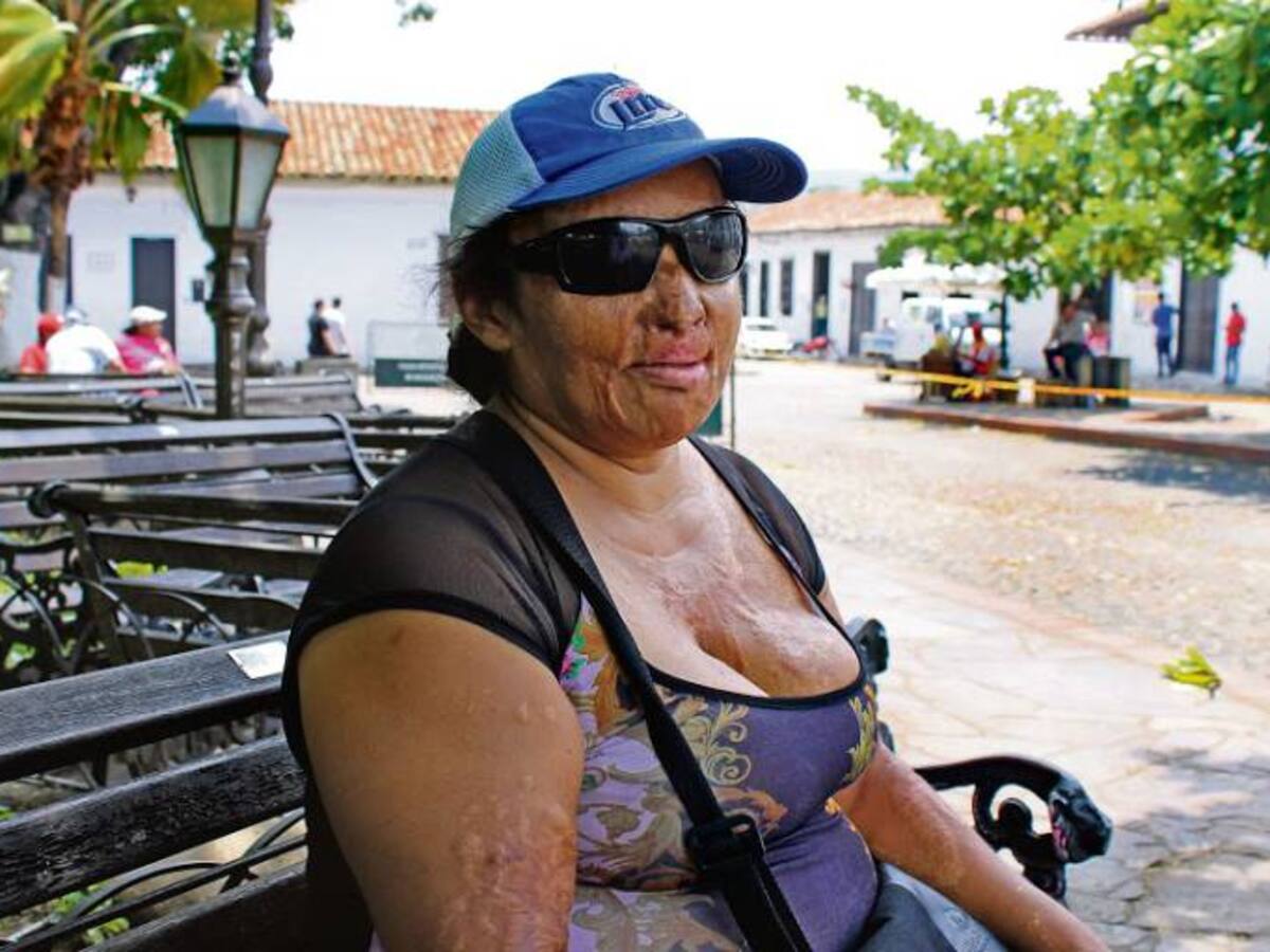 Víctimas santandereanas de ataques con ácido celebran castigos más severos