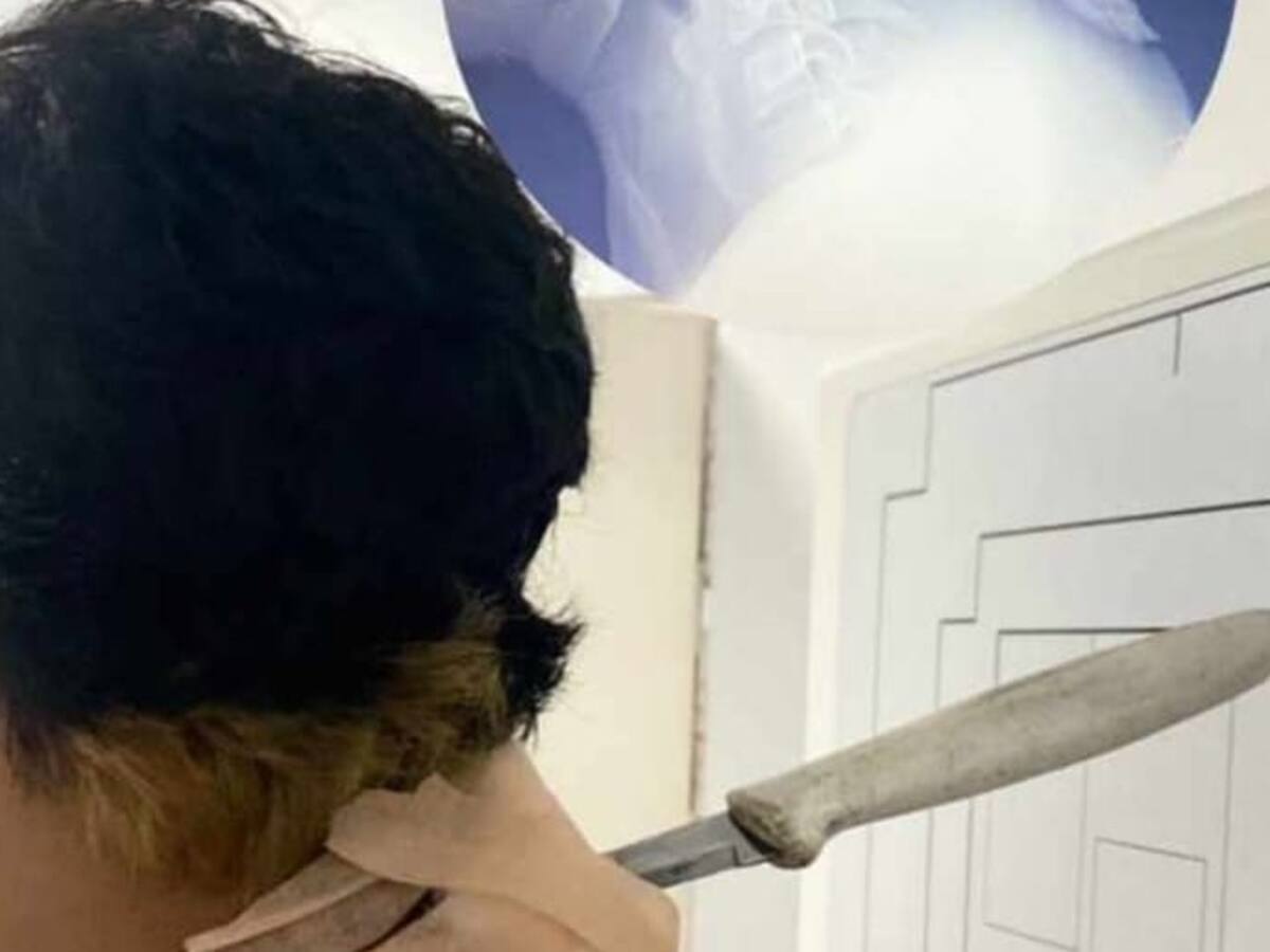 ¡Estuvo por varias horas con un cuchillo incrustado en el cuello y logró sobrevivir!