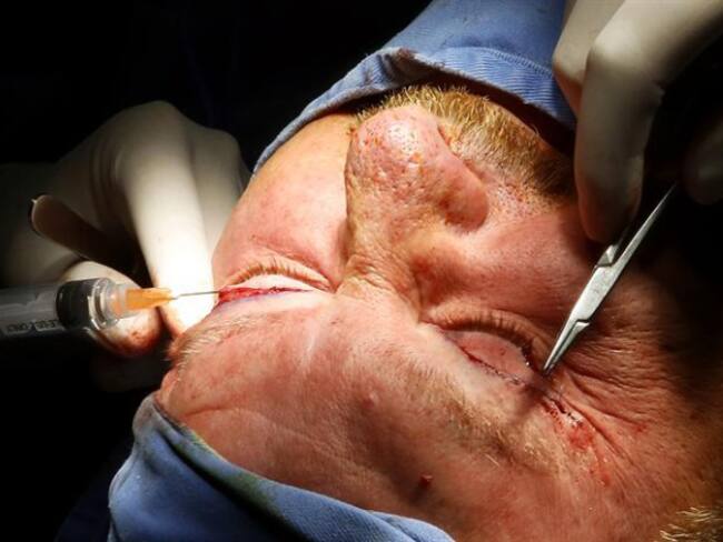 ¿Quién le va a cantar la tabla a la ministra Parody sobre cirugías plásticas?