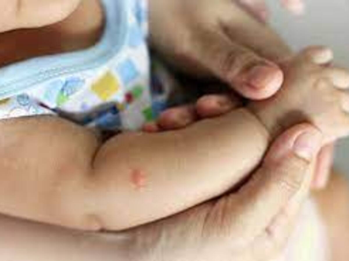 Analizan muerte de un menor de edad por dengue en el Huila