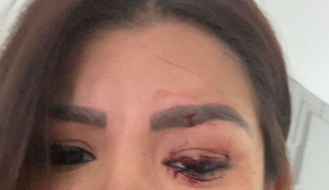 Abogada víctima de hurto en Ibagué