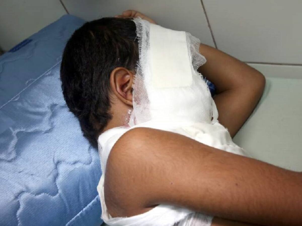 Tres quemados con pólvora en Norte de Santander