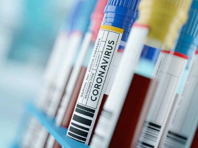 Alertas por pacientes asintomáticos de Coronavirus en Norte de Santander
