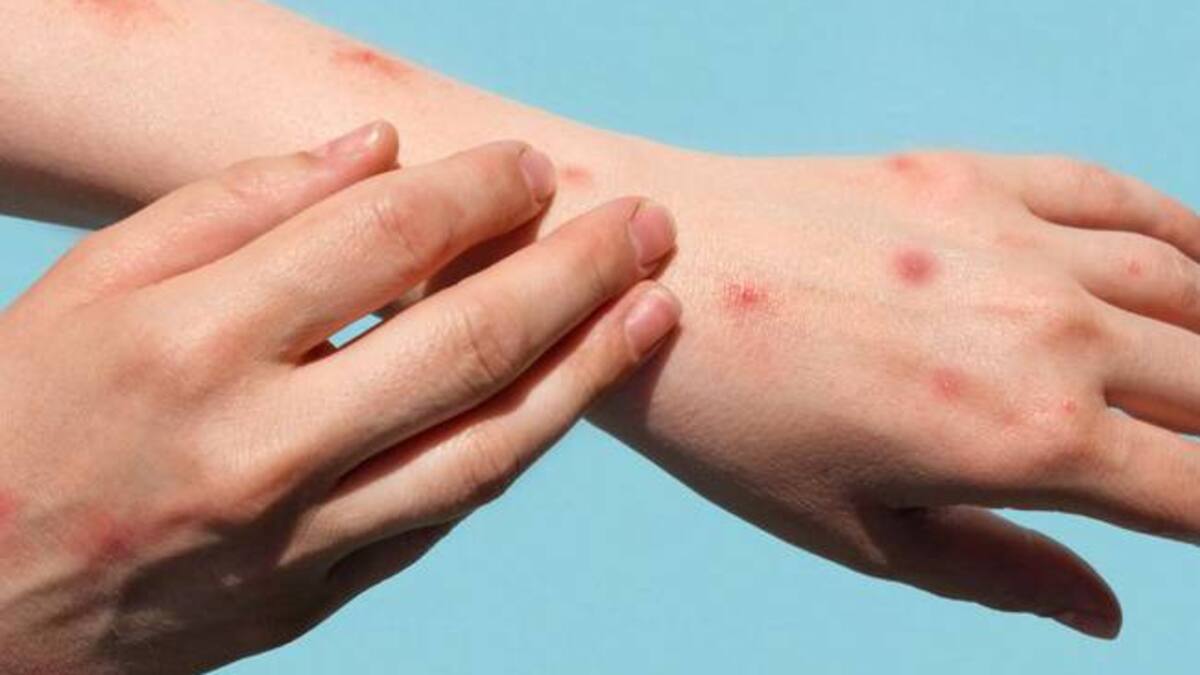 Epidemióloga de la Secertaría de Salud del Quindío,, Ana Cecilia López