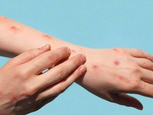 Epidemióloga de la Secertaría de Salud del Quindío,, Ana Cecilia López