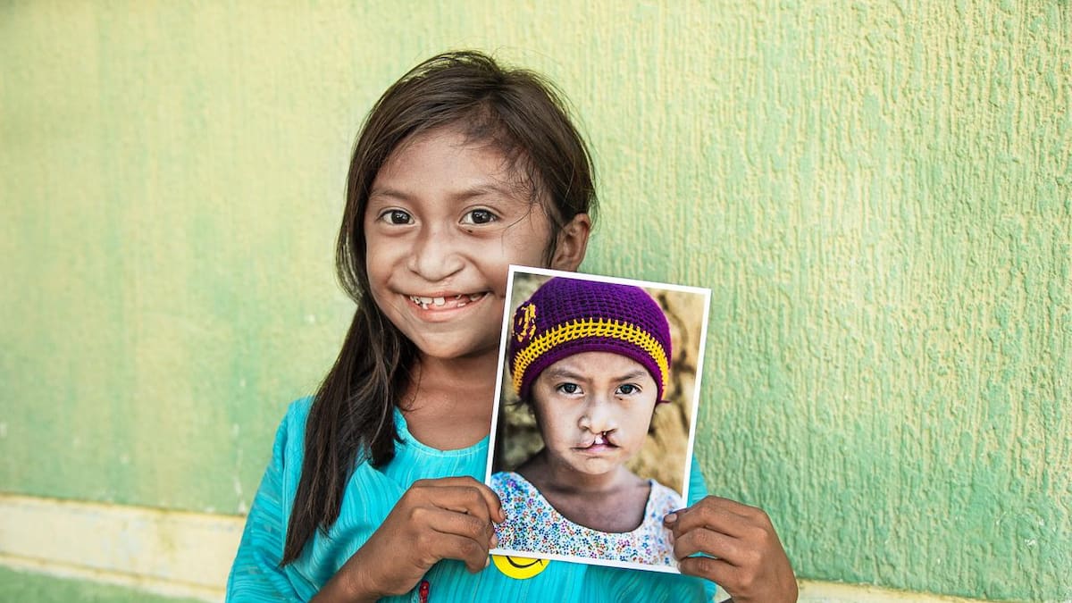 Lista Operación Sonrisa para 20 niños en Duitama, Boyacá