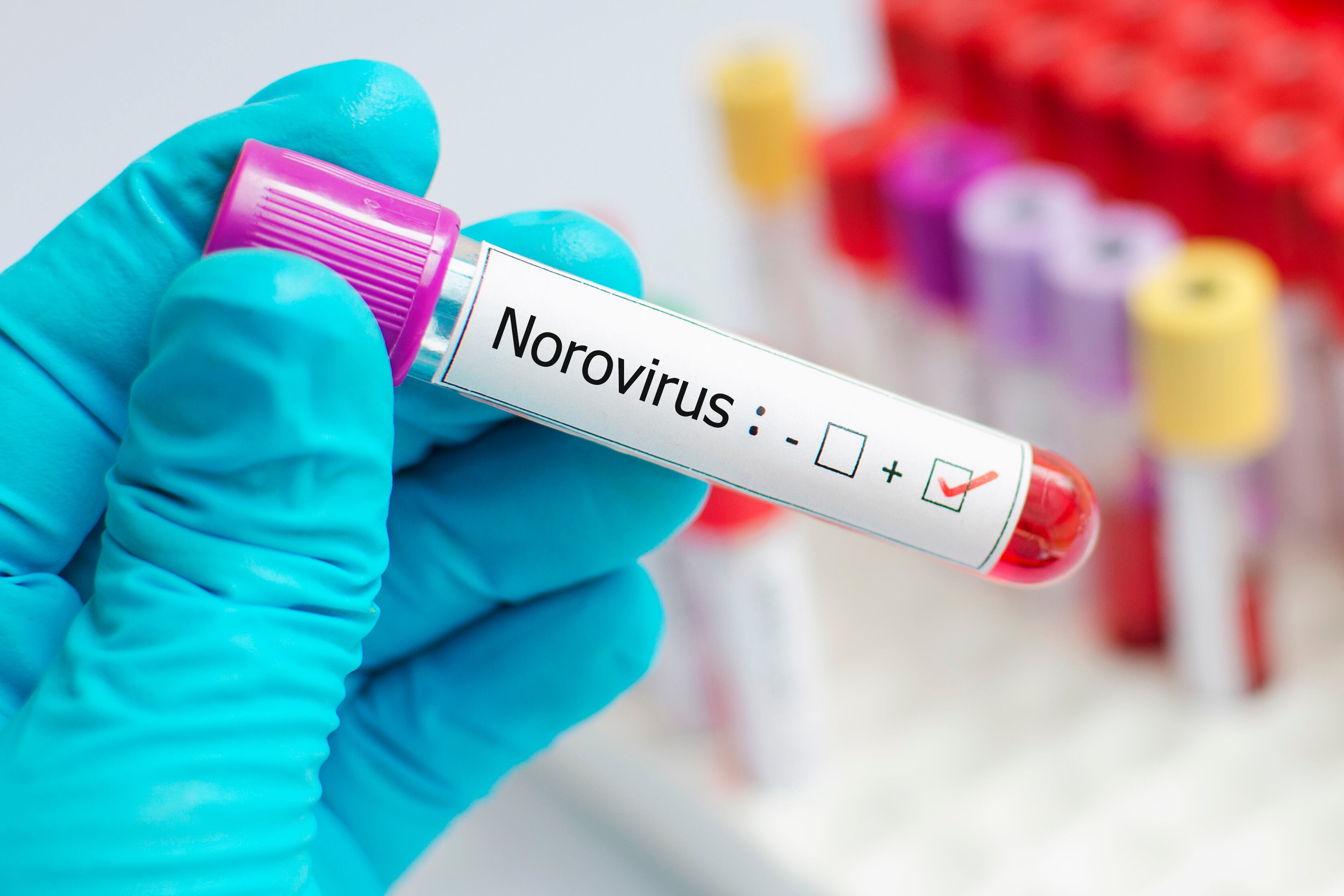 Norovirus: Nuevo brote identificado en un crucero ¿qué es y cómo se contagia? Foto: GettyImages