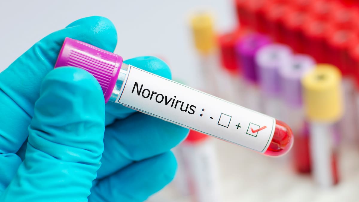 Norovirus: Nuevo brote identificado en un crucero ¿Qué es y cómo se contagia?