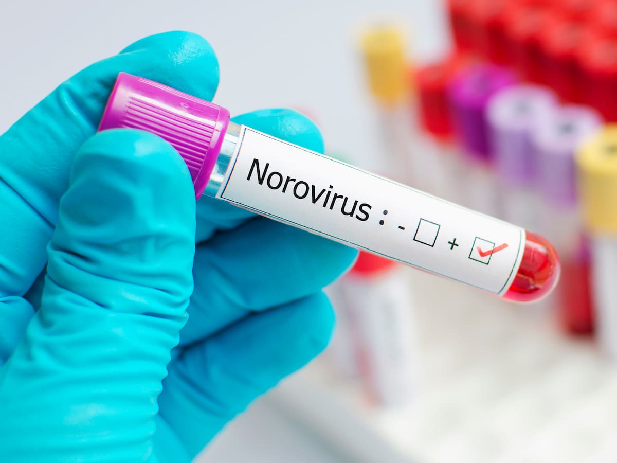 Norovirus: Nuevo brote identificado en un crucero ¿Qué es y cómo se contagia?
