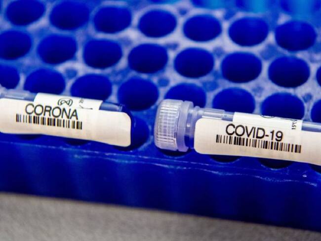 Antioquia asumirá la demanda de las pruebas de COVID-19 en el departamento