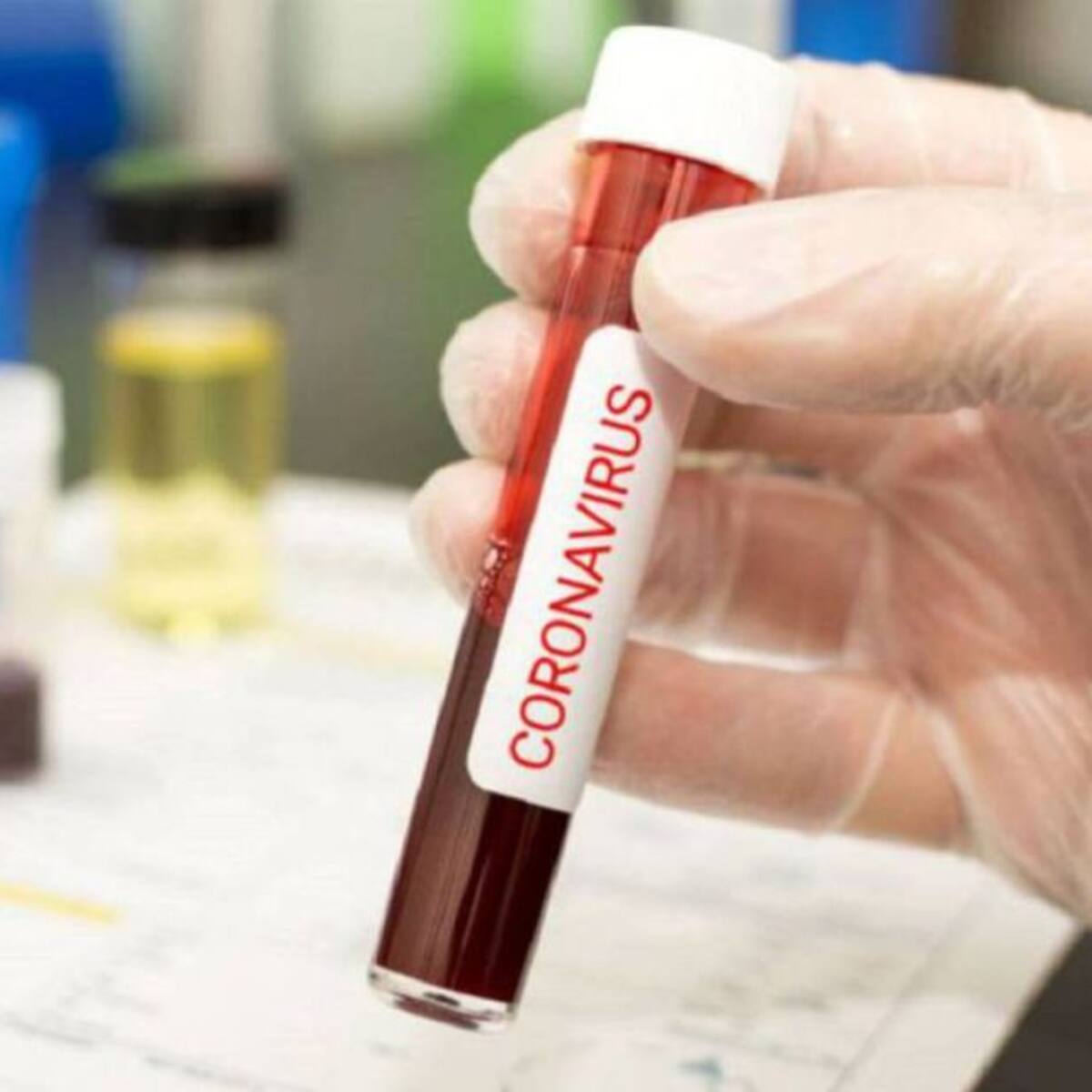 Alerta en Pereira por cadenas falsas de WhatsApp sobre el coronavirus