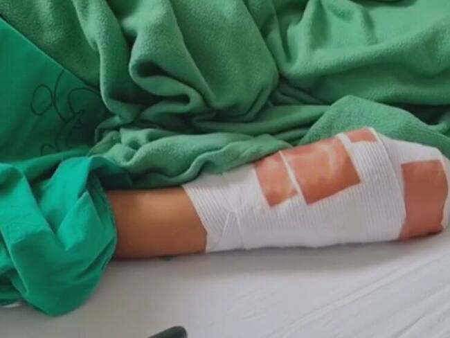 Trasladarán a Barranquilla a menor que fue quemada con ácido en el departamento de Sucre