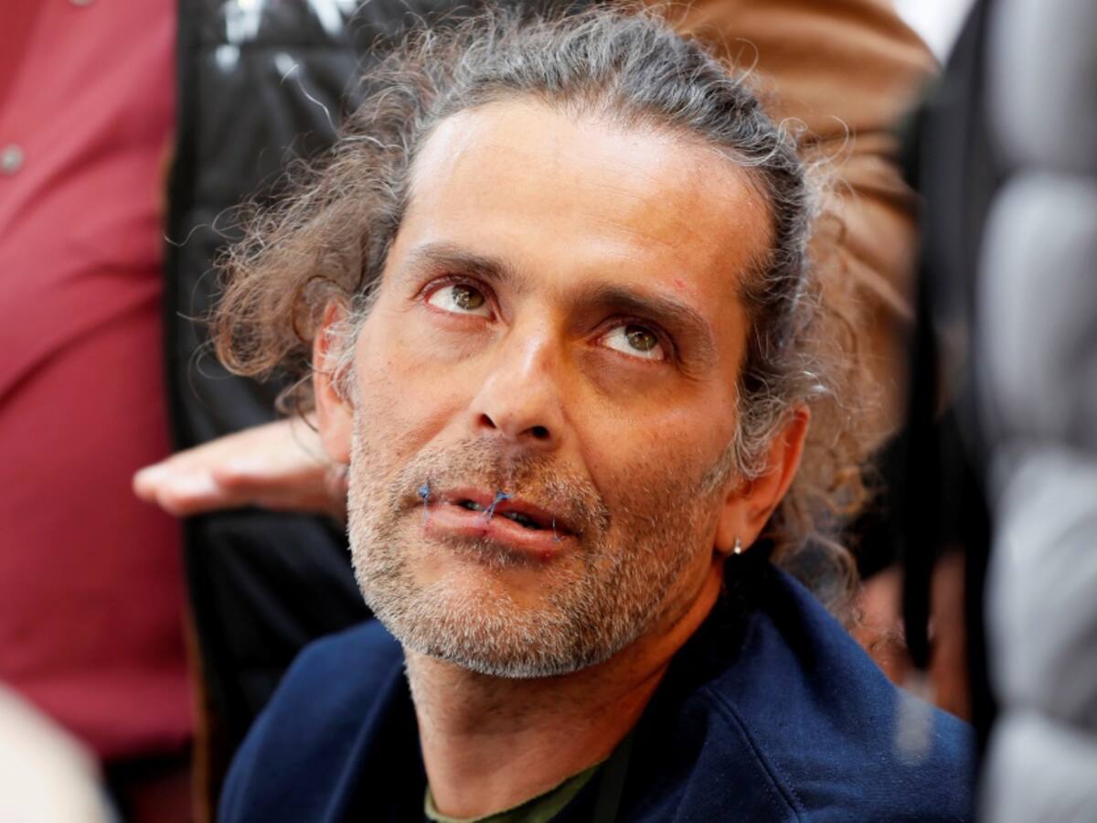 "La salud de Fitzgerald es crítica": Secretaría de Gobierno Bogotá