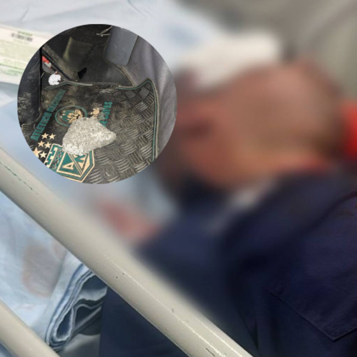 Tres funcionarios de la alcaldía fueron agredidos por un conductor infractor; uno con lesiones grave