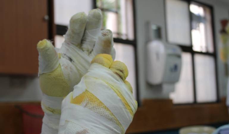 Cabe recordar que el Quindío es uno de los departamentos que más reporta quemados con pólvora en el país