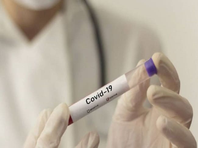 4 nuevas víctimas y 170 contagios del COVID- 19 en el Atlántico