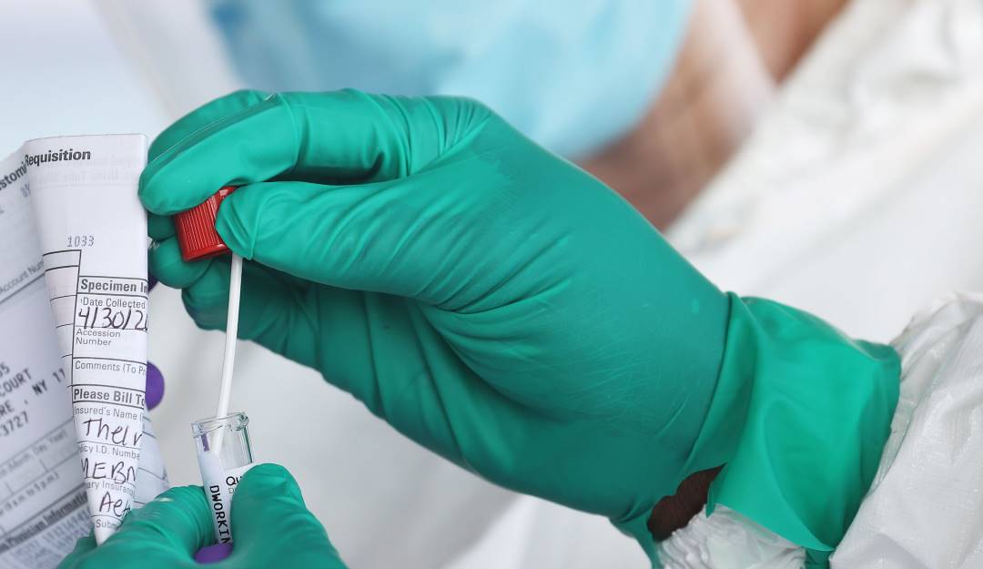 Revisión de prueba contra el coronavirus.     Foto: Getty 