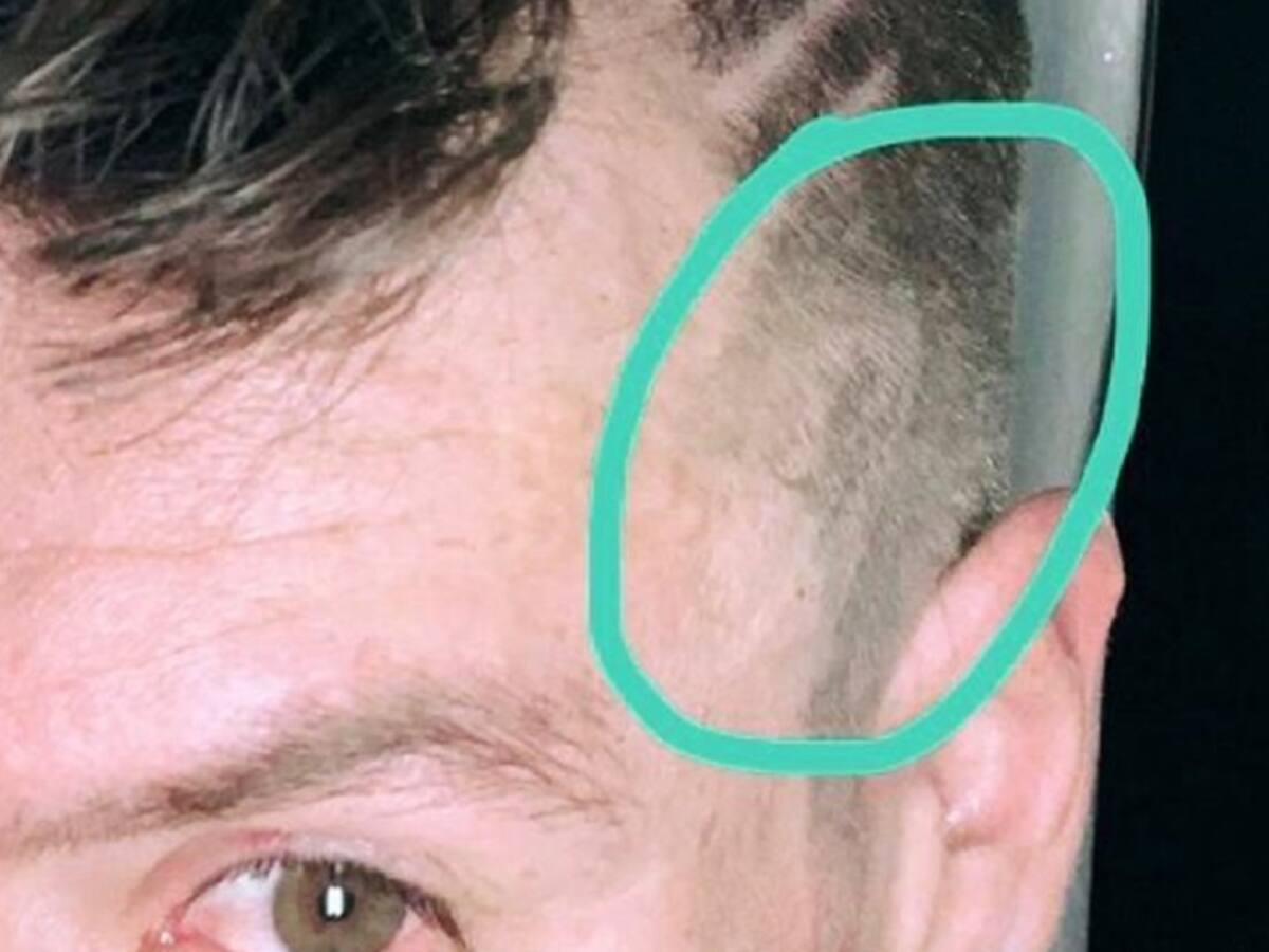 Le "sacaron la piedra" a 'Rigo', su esposa lo puso a estrenar peinado