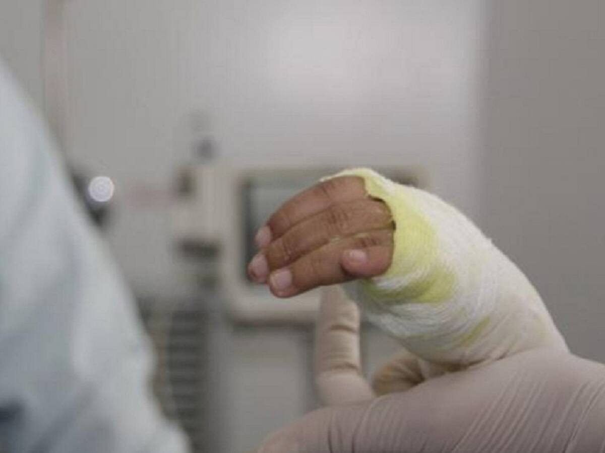 Niñas que sufrieron quemaduras en rostros serán trasladadas a un hospital de mayor nivel