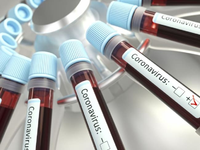 Cinco nuevos casos de Coronavirus en Norte de Santander