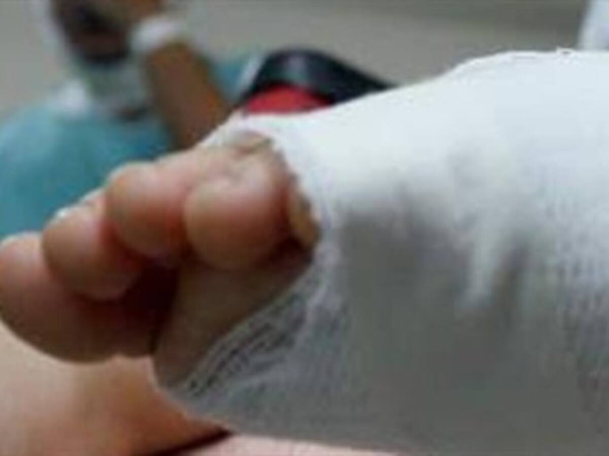 Seis quemados con pólvora en el ‘Día de las velitas’ en Bogotá