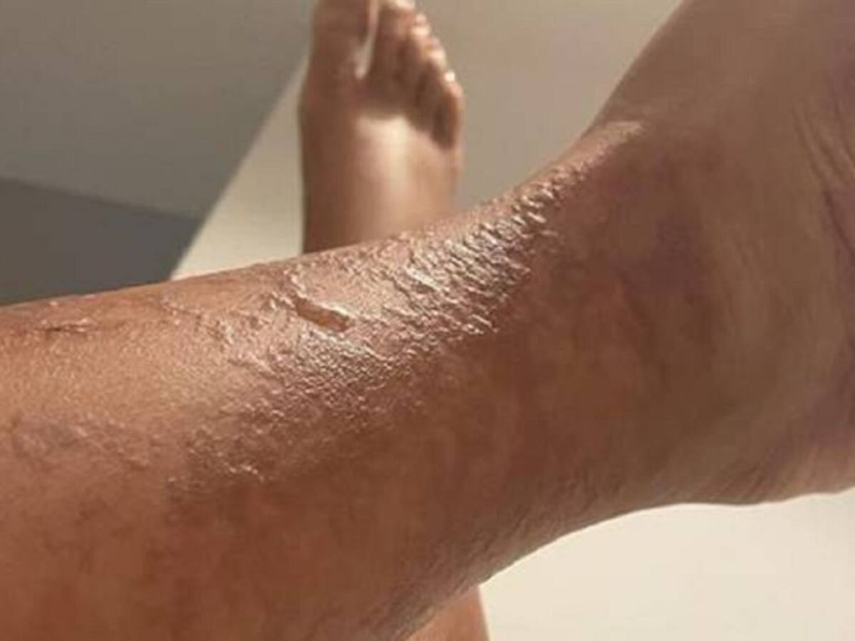 Piden cerrar Clínica Estética de Manizales por tener heridas en el cuerpo