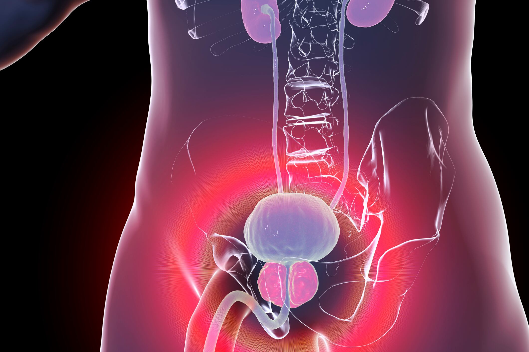 Cáncer de prostata imagen de referencia. Foto: Getty Images.