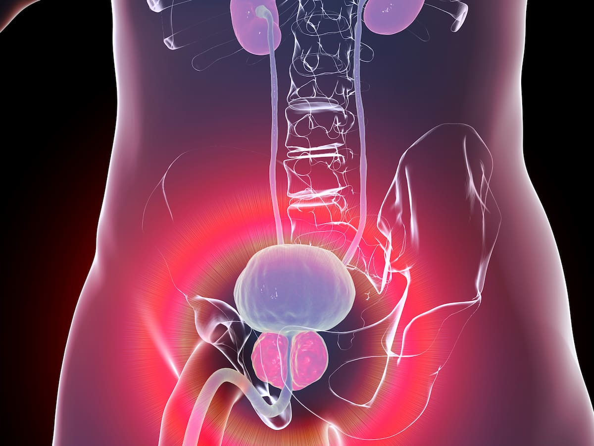 En el INC implementan un nuevo tratamiento para el cáncer de próstata que es menos radioactivo