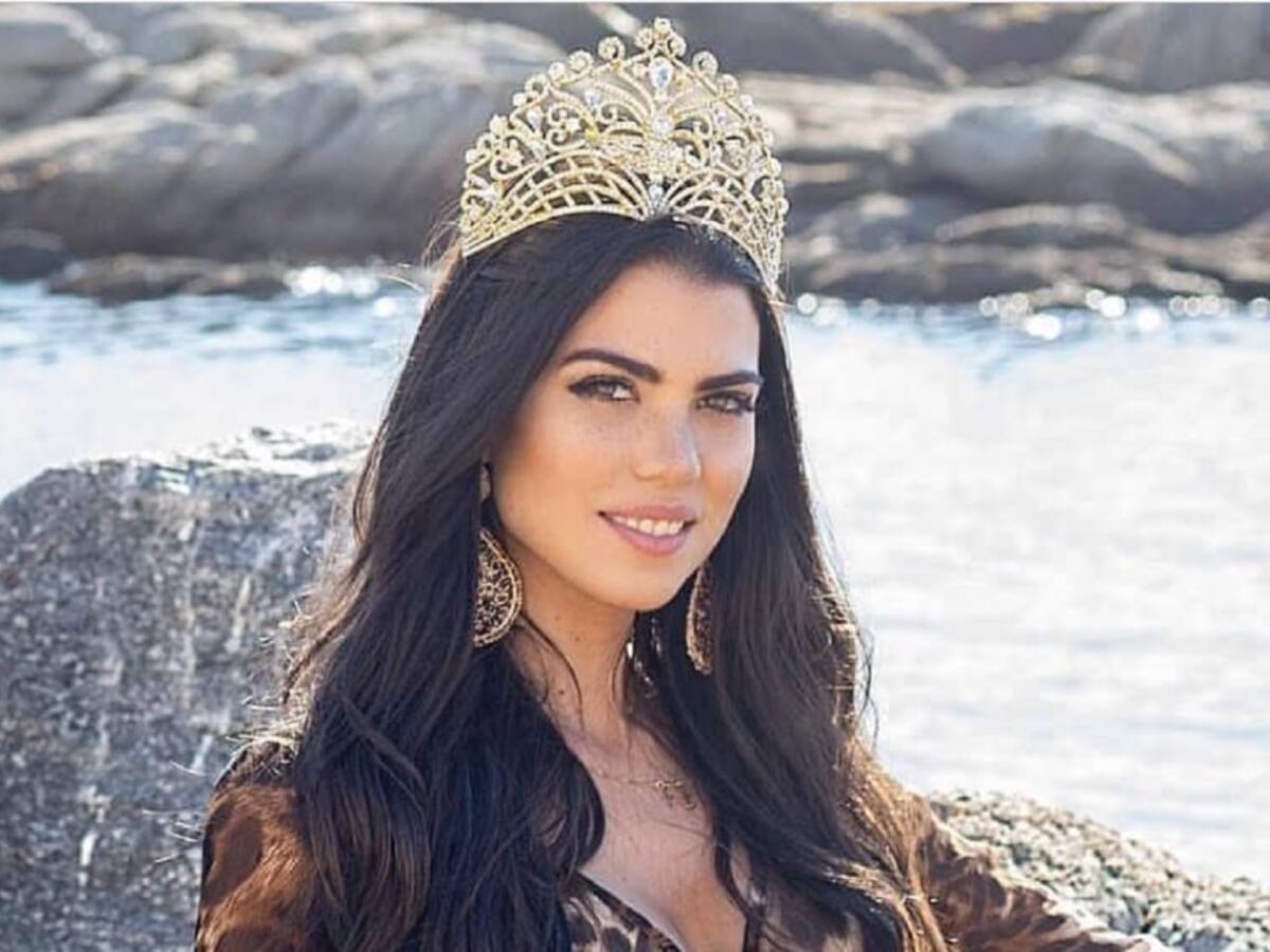 Miss Chile y el trágico momento que vivió con su rostro quemado con ácido