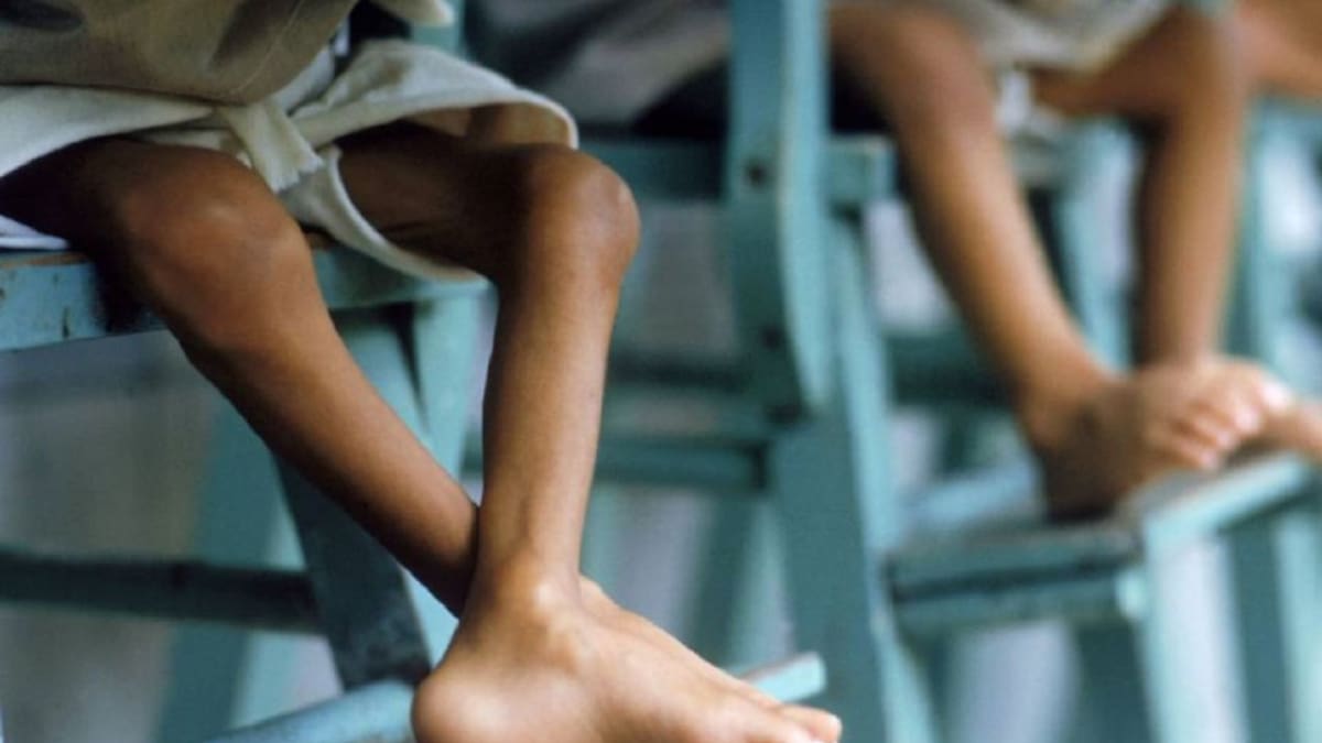 Defensoría pide medidas por muertes de niños por desnutrición en La Guajira