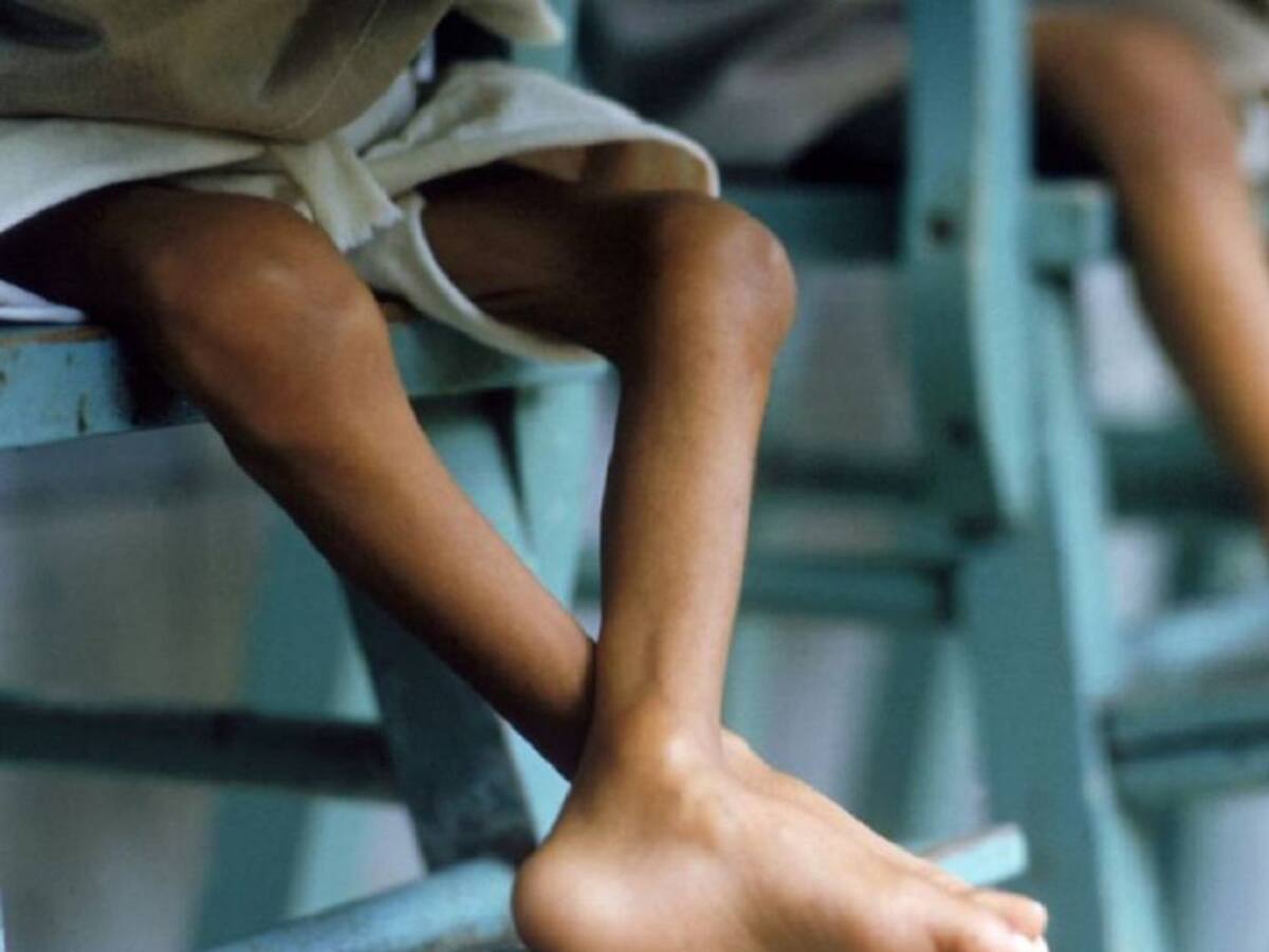 Defensoría pide medidas por muertes de niños por desnutrición en La Guajira