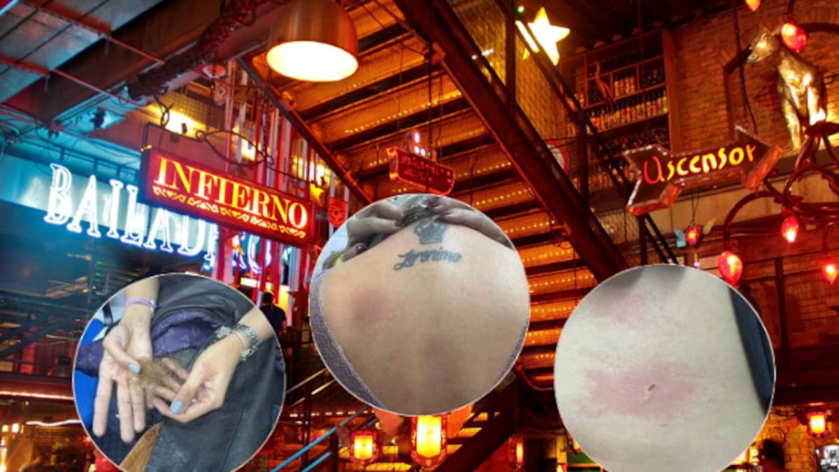 Exigen reparación y no repetición, no fueron quemaduras leves: abogado de víctimas Andrés DC