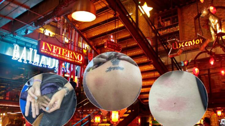 Exigen reparación y no repetición, no fueron quemaduras leves: abogado de víctimas Andrés DC