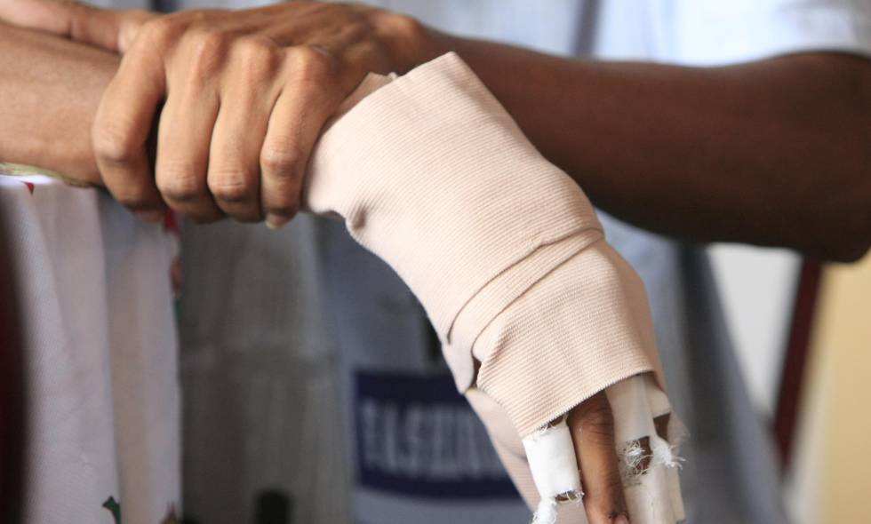 El hombre de 20 años resultó afectado con un elemento tipo tote.