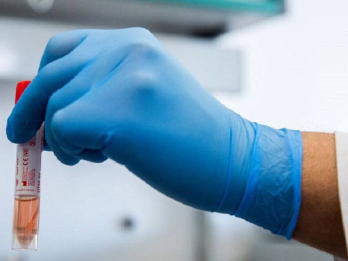 Procuraduría alertó sobre deficiencias en muestras para confirmar COVID-19