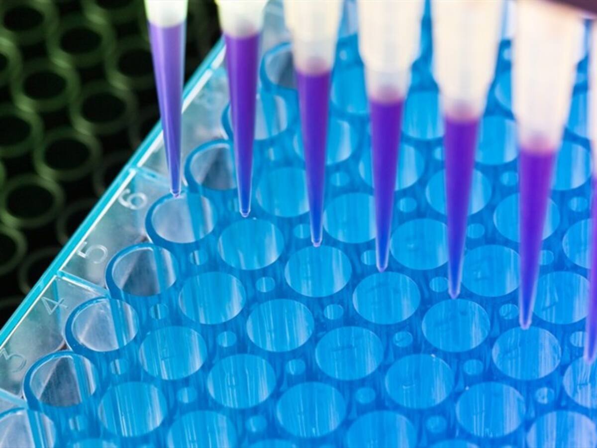 Universidad de los Andes realizará 100.000 pruebas de COVID-19 en Bogotá